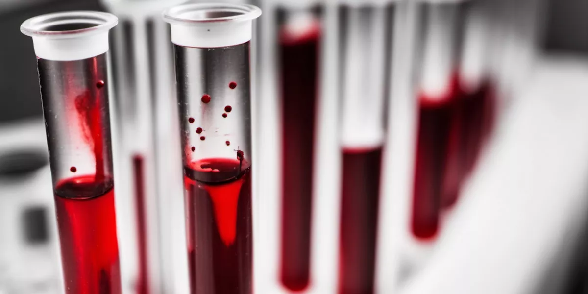 Ученые решили рассказать, какие особенности в крови помогают дожить до 100 лет